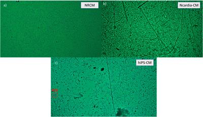 Development of a high-speed imaging system for real time evaluation and monitoring of cardiac engineered tissues